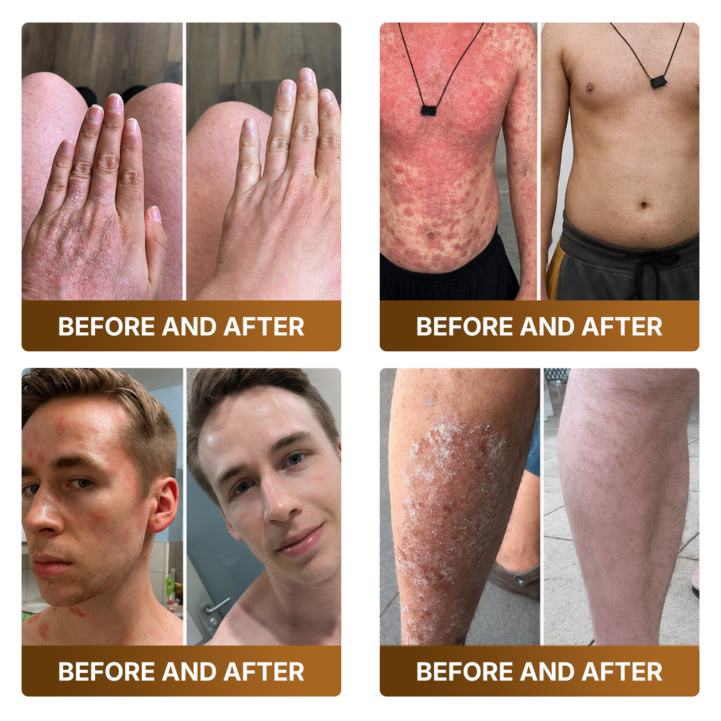 【Made and Shipped from US】🚀  DOCTIA® Botox & Bee Venom Advanced Recovery Cream—For Wrinkles, Sagging Skin, Skin Tags & Rough Bumps⚡