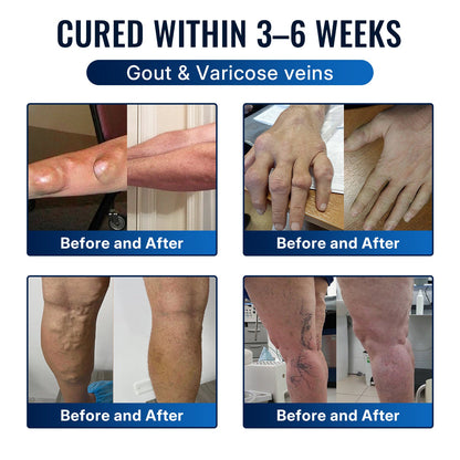 𝐇еа𝐥𝐫𝐢𝐳е® 🌿𝐁ее 𝐕е𝐧𝐨𝐦 𝐉𝐨𝐢𝐧𝐭 𝐑е𝐥𝐢е𝐟 𝐂𝐫еа𝐦 🌿Fast-Acting Comfort for Stiff Knees, Hands, Back & Everyday Joint Discomfort