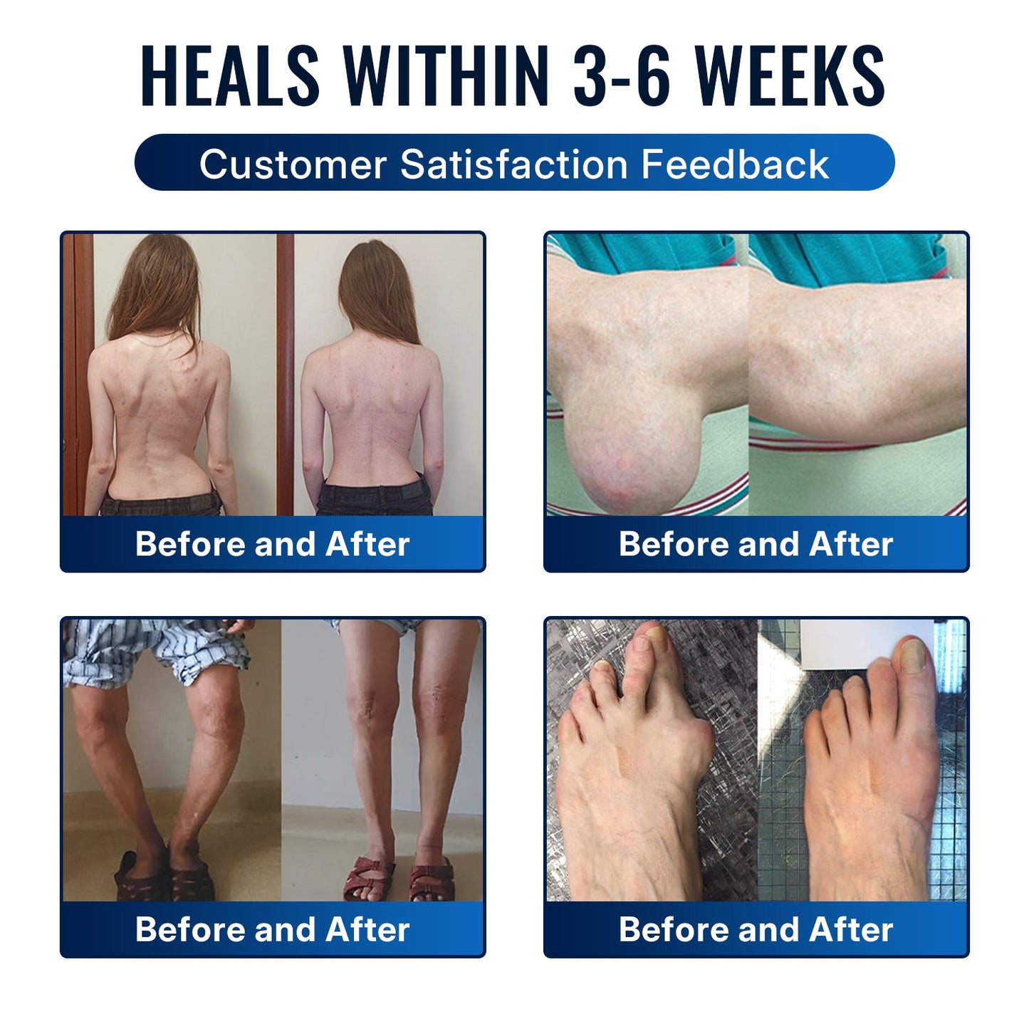 𝐇еа𝐥𝐫𝐢𝐳е® 🌿𝐁ее 𝐕е𝐧𝐨𝐦 𝐉𝐨𝐢𝐧𝐭 𝐑е𝐥𝐢е𝐟 𝐂𝐫еа𝐦 🌿Fast-Acting Comfort for Stiff Knees, Hands, Back & Everyday Joint Discomfort