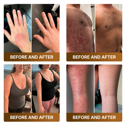 【Made and Shipped from US】🚀  DOCTIA® Botox & Bee Venom Advanced Recovery Cream—For Wrinkles, Sagging Skin, Skin Tags & Rough Bumps⚡