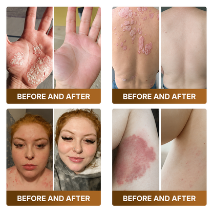 【Made and Shipped from US】🚀  DOCTIA® Botox & Bee Venom Advanced Recovery Cream—For Wrinkles, Sagging Skin, Skin Tags & Rough Bumps⚡