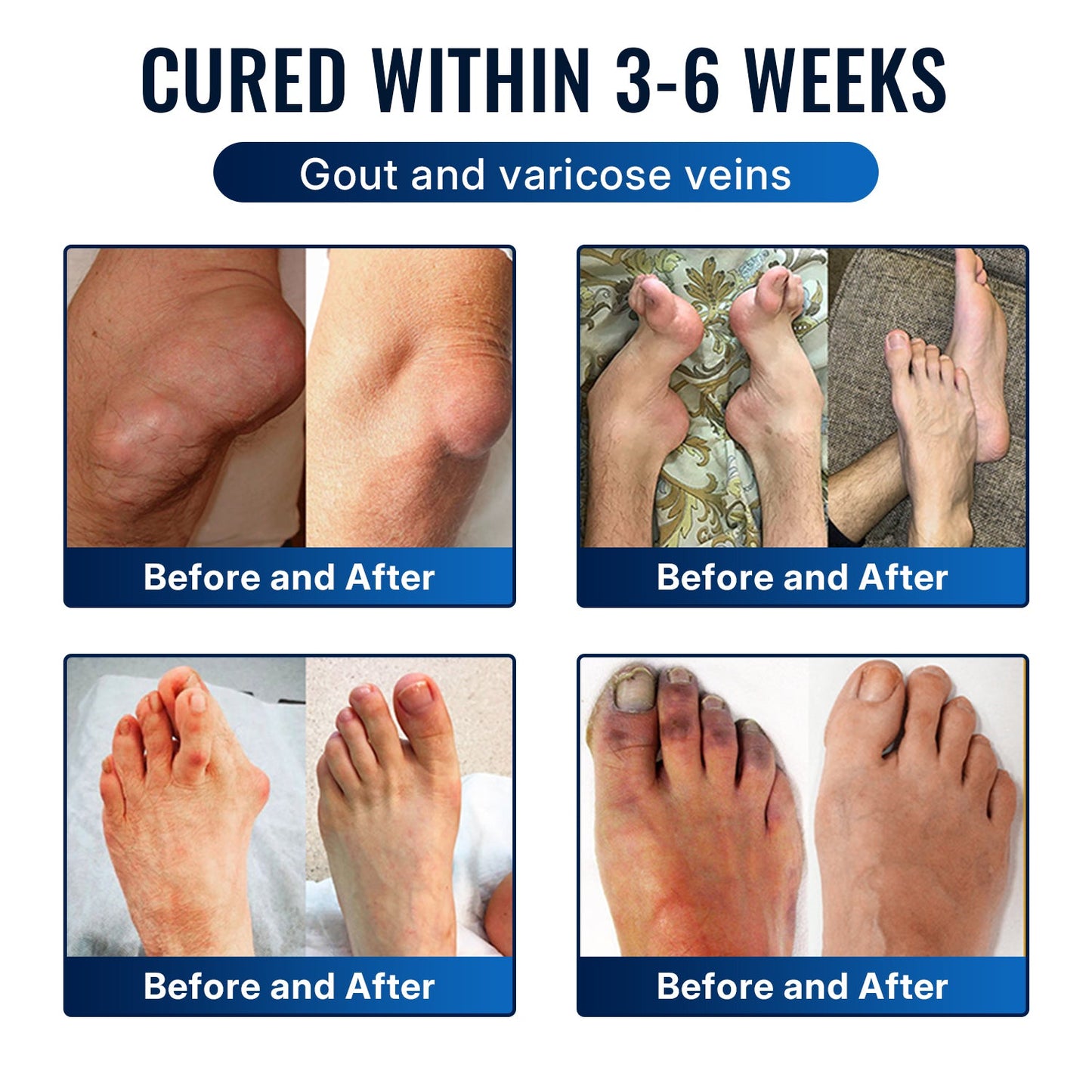 𝐇еа𝐥𝐫𝐢𝐳е® 🌿𝐁ее 𝐕е𝐧𝐨𝐦 𝐉𝐨𝐢𝐧𝐭 𝐑е𝐥𝐢е𝐟 𝐂𝐫еа𝐦 🌿Fast-Acting Comfort for Stiff Knees, Hands, Back & Everyday Joint Discomfort