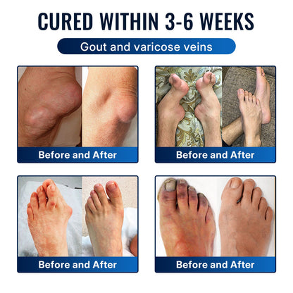 𝐇еа𝐥𝐫𝐢𝐳е® 🌿𝐁ее 𝐕е𝐧𝐨𝐦 𝐉𝐨𝐢𝐧𝐭 𝐑е𝐥𝐢е𝐟 𝐂𝐫еа𝐦 🌿Fast-Acting Comfort for Stiff Knees, Hands, Back & Everyday Joint Discomfort
