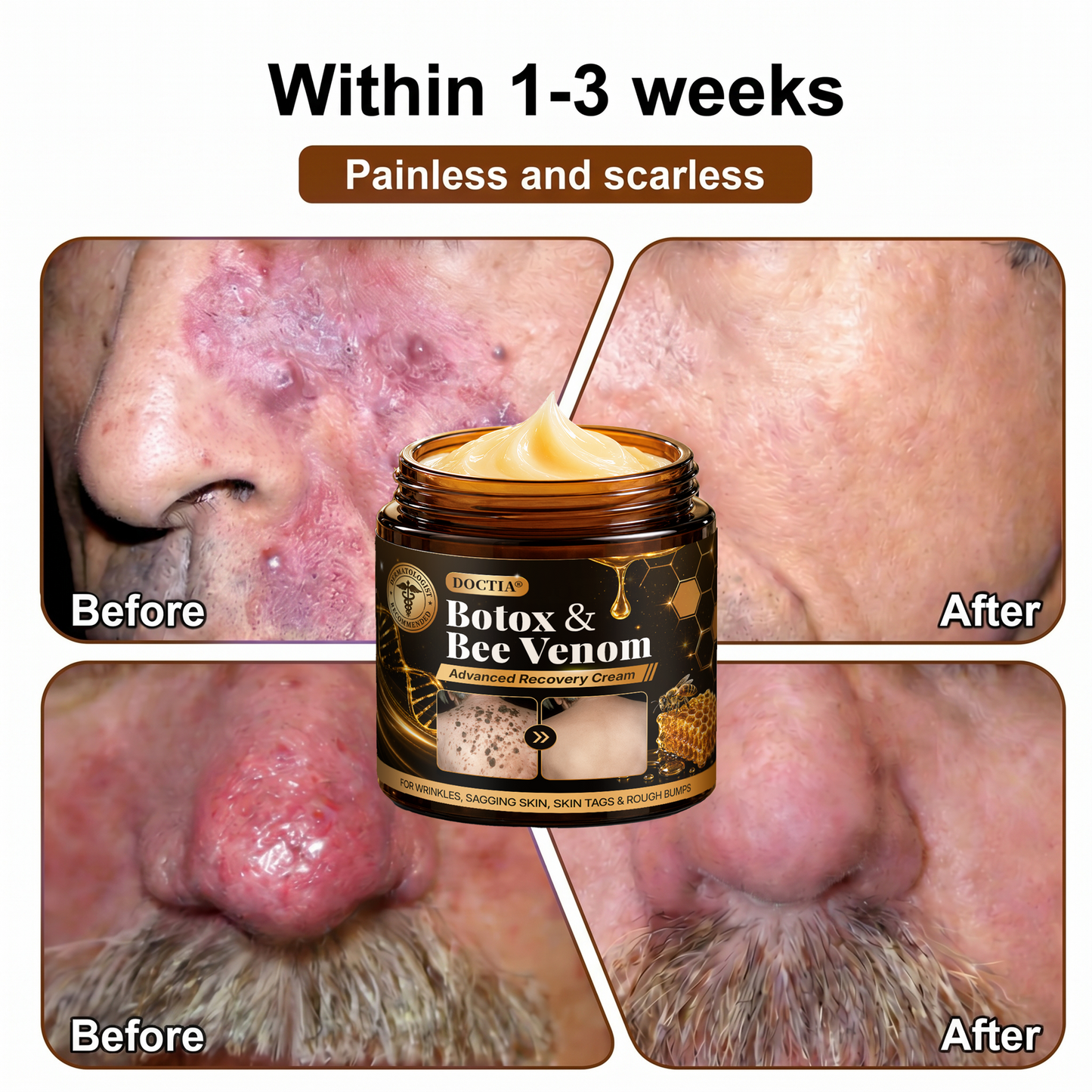 【Made and Shipped from US】💌 DOCTIA® Botox & Bee Venom Advanced Recovery Cream—For Wrinkles, Sagging Skin, Skin Tags & Rough Bumps 🇺🇸