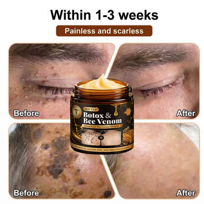 【Made and Shipped from US】💌 DOCTIA® Botox & Bee Venom Advanced Recovery Cream—For Wrinkles, Sagging Skin, Skin Tags & Rough Bumps 🇺🇸