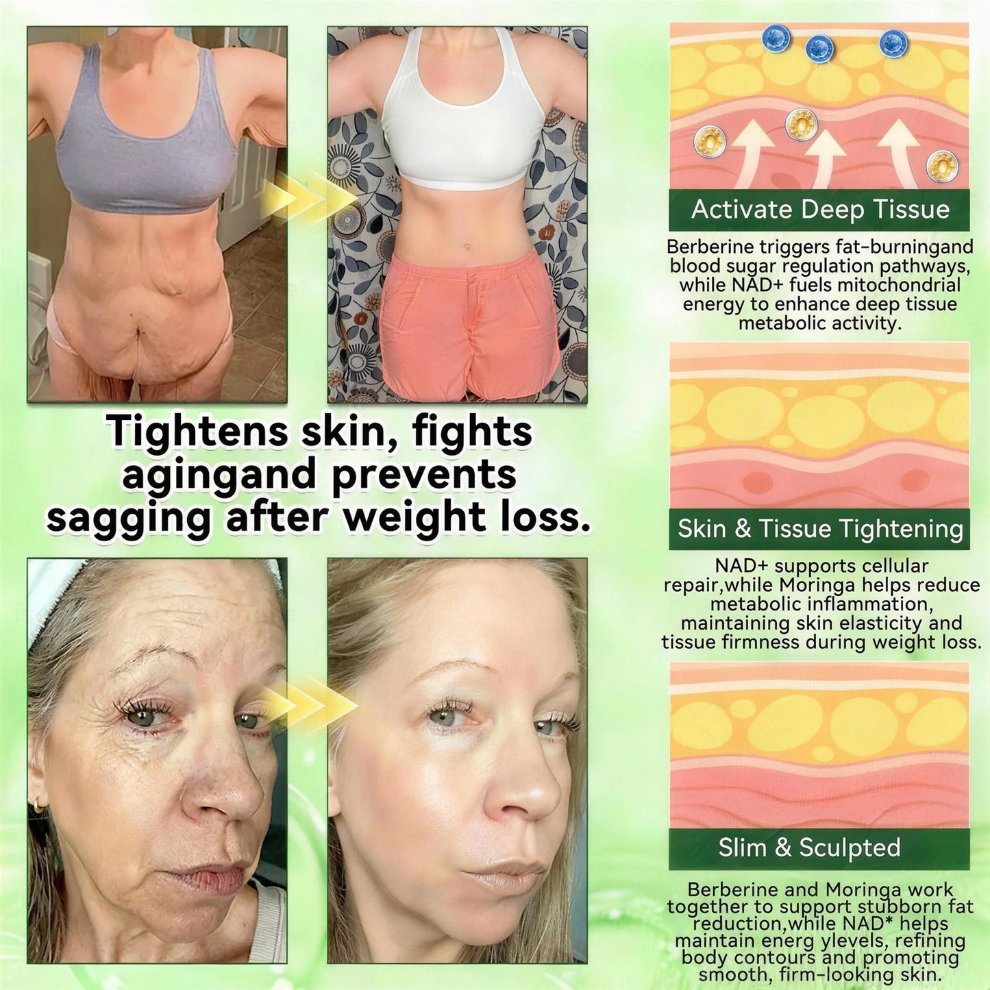 𝑶𝒇𝒇𝒊𝒄𝒊𝒂𝒍 𝒔𝒕𝒐𝒓𝒆  | Surgoᴎix®🏥 𝐌𝐨𝐫𝐢𝐧𝒈𝗮 𝑩𝒆𝒓𝒃𝒆𝐫𝐢𝐧𝐞𝐱 𝐍𝗔𝒟+ 10-𝑖n-1 𝐍a𝒏𝒐 𝐌𝐢𝐜𝐫𝑜𝑛𝑒𝑒𝗱𝗹𝗲 𝐏𝐚𝒕𝒄𝒉(𝐉𝐮𝐬𝐭 𝐨𝐧𝐜𝐞 𝐚 𝐝𝐚𝐲, 𝐯𝐢𝐬𝐢𝐛𝐥𝐞 𝐜𝐡𝐚𝐧𝐠𝐞𝐬 𝐢𝐧 𝟕 𝑫𝐚𝐲𝐬） 𝐅𝐨𝐫 𝐎𝐛𝐞𝐬𝐢𝐭𝐲,  𝙇𝙊𝙊𝙎𝗘 𝗦𝗞𝗜𝗡,𝐝𝐢𝐚𝐛𝐞𝐭𝙚𝙨, 𝐬𝐥𝐞𝐞𝐏 𝐚𝐩𝐧𝐞𝐚, 𝐣𝐨𝐢𝐧𝐭 𝐢𝐬𝐬𝐮𝙚𝙨, 𝐚𝐧𝐝 𝐦𝐨𝐫𝐞 ⚡