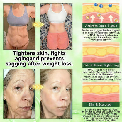 𝑶𝒇𝒇𝒊𝒄𝒊𝒂𝒍 𝒔𝒕𝒐𝒓𝒆  | Surgoᴎix®🏥 𝐌𝐨𝐫𝐢𝐧𝒈𝗮 𝑩𝒆𝒓𝒃𝒆𝐫𝐢𝐧𝐞𝐱 𝐍𝗔𝒟+ 10-𝑖n-1 𝐍a𝒏𝒐 𝐌𝐢𝐜𝐫𝑜𝑛𝑒𝑒𝗱𝗹𝗲 𝐏𝐚𝒕𝒄𝒉(𝐉𝐮𝐬𝐭 𝐨𝐧𝐜𝐞 𝐚 𝐝𝐚𝐲, 𝐯𝐢𝐬𝐢𝐛𝐥𝐞 𝐜𝐡𝐚𝐧𝐠𝐞𝐬 𝐢𝐧 𝟕 𝑫𝐚𝐲𝐬） 𝐅𝐨𝐫 𝐎𝐛𝐞𝐬𝐢𝐭𝐲,  𝙇𝙊𝙊𝙎𝗘 𝗦𝗞𝗜𝗡,𝐝𝐢𝐚𝐛𝐞𝐭𝙚𝙨, 𝐬𝐥𝐞𝐞𝐏 𝐚𝐩𝐧𝐞𝐚, 𝐣𝐨𝐢𝐧𝐭 𝐢𝐬𝐬𝐮𝙚𝙨, 𝐚𝐧𝐝 𝐦𝐨𝐫𝐞 ⚡