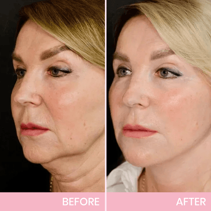 V-Face Lifting Invisible Adhesive Tape 10✔️