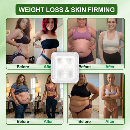 [2026 New & Upgraded: 80% OFF] ✅ Healrize® Lymphatic Drainage Slimming Nano-Microneedle Patch: Advanced transdermal patch designed to support fat metabolism, appetite control, lymphatic flow, and firmer-looking skin — without pills, injections